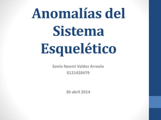 Anomalías del
Sistema
Esquelético
Sonia Noemi Valdez Arreola
0121420479
30 abril 2014
 