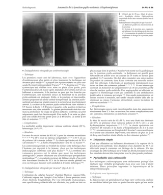 Anomalie de la jonction pyélo urétérale et hydronéphrose | PDF