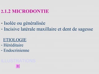2.1.2 MICRODONTIE
- Isolée ou généralisée
- Incisive latérale maxillaire et dent de sagesse
ETIOLOGIE
- Héréditaire
- Endocrinienne
ILLUSTRATIONS
 