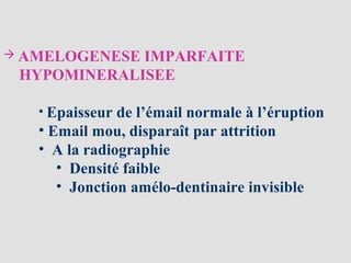  AMELOGENESE IMPARFAITE
HYPOMINERALISEE
• Epaisseur de l’émail normale à l’éruption
• Email mou, disparaît par attrition
• A la radiographie
• Densité faible
• Jonction amélo-dentinaire invisible
 