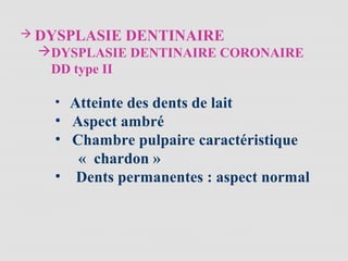  DYSPLASIE DENTINAIRE
DYSPLASIE DENTINAIRE CORONAIRE
DD type II
• Atteinte des dents de lait
• Aspect ambré
• Chambre pulpaire caractéristique
« chardon »
• Dents permanentes : aspect normal
 