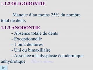 1.1.2 OLIGODONTIE
Manque d’au moins 25% du nombre
total de dents
1.1.3 ANODONTIE
- Absence totale de dents
- Exceptionnelle
- 1 ou 2 dentures
- Uni ou bimaxillaire
- Associée à la dysplasie éctodermique
anhydrotique Illustrations
 