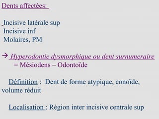 Dents affectées:
Incisive latérale sup
Incisive inf
Molaires, PM
 Hyperodontie dysmorphique ou dent surnumeraire
= Mésiodens – Odontoïde
Définition : Dent de forme atypique, conoïde,
volume réduit
Localisation : Région inter incisive centrale sup
 