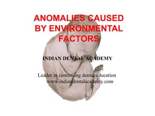 ANOMALIES CAUSED
BY ENVIRONMENTAL
FACTORS
INDIAN DENTAL ACADEMY
Leader in continuing dental education
www.indiandentalacademy.com

 