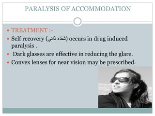 SPASM OF ACCOMMODATION
Investigation:-
-Cycloplegic refraction used to determine true
refraction.(atropine drops for 2-4 ...
