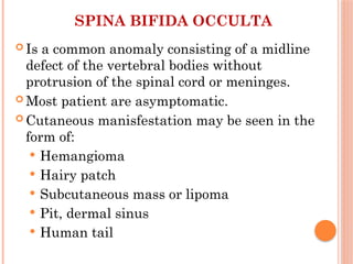 Anomalies of CNS+ Hydrocephalus in neonate.pptx