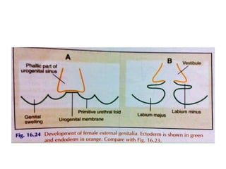 Anomalies of Female Reproductive System (Embryology-uterus, uterine t…