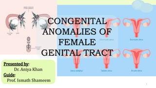 1
Presented by:
Dr. Aniya Khan
Guide:
Prof. Ismath Shameem
CONGENITAL
ANOMALIES OF
FEMALE
GENITAL TRACT
 