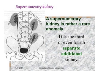 Anomalies of Genito-Urinary Tract.ppt