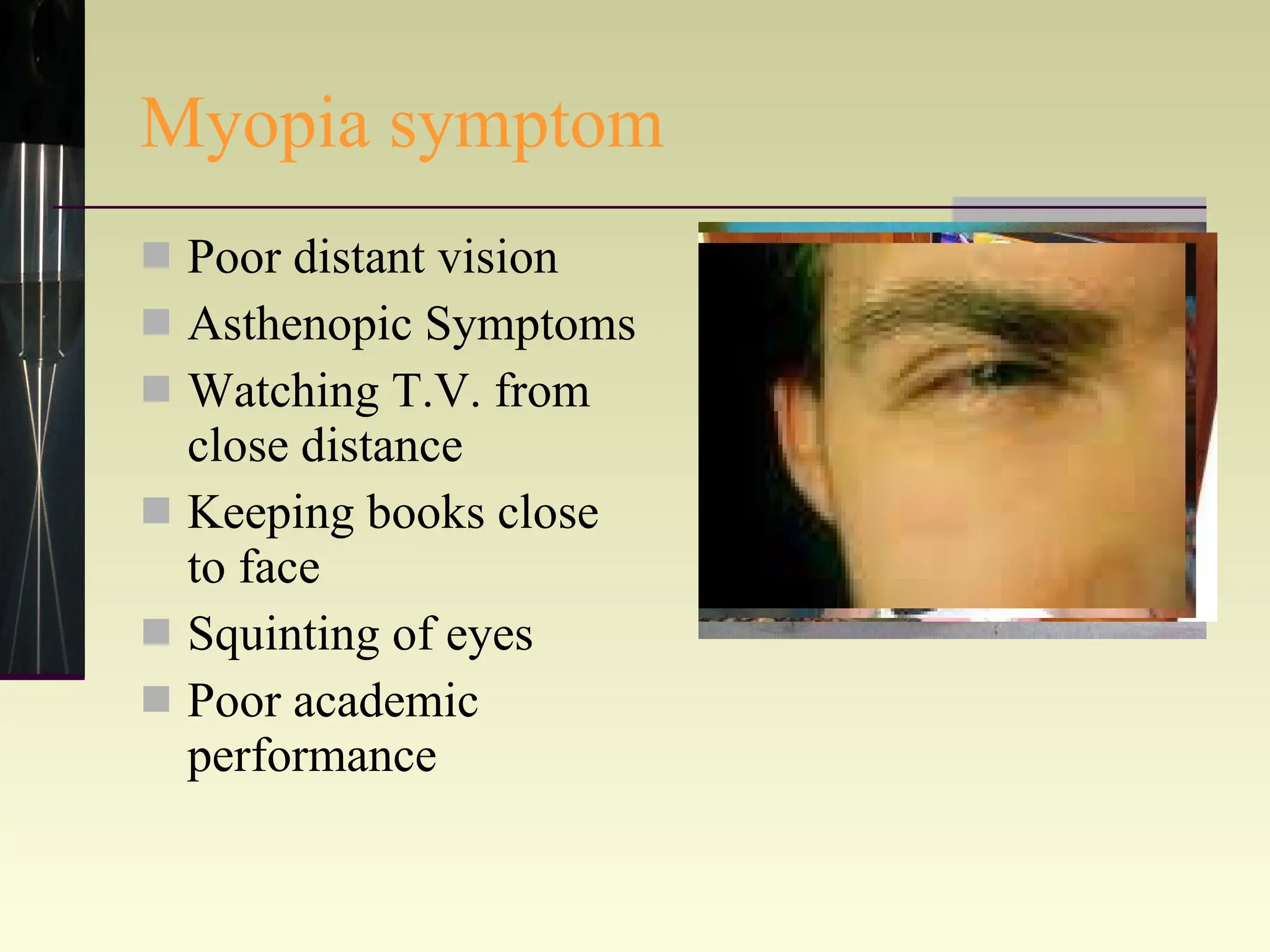 Myopia symptom Poor distant vision Asthenopic Symptoms Watching T.V. from close distance Keeping books close to face Squinting of eyes Poor academic performance 
