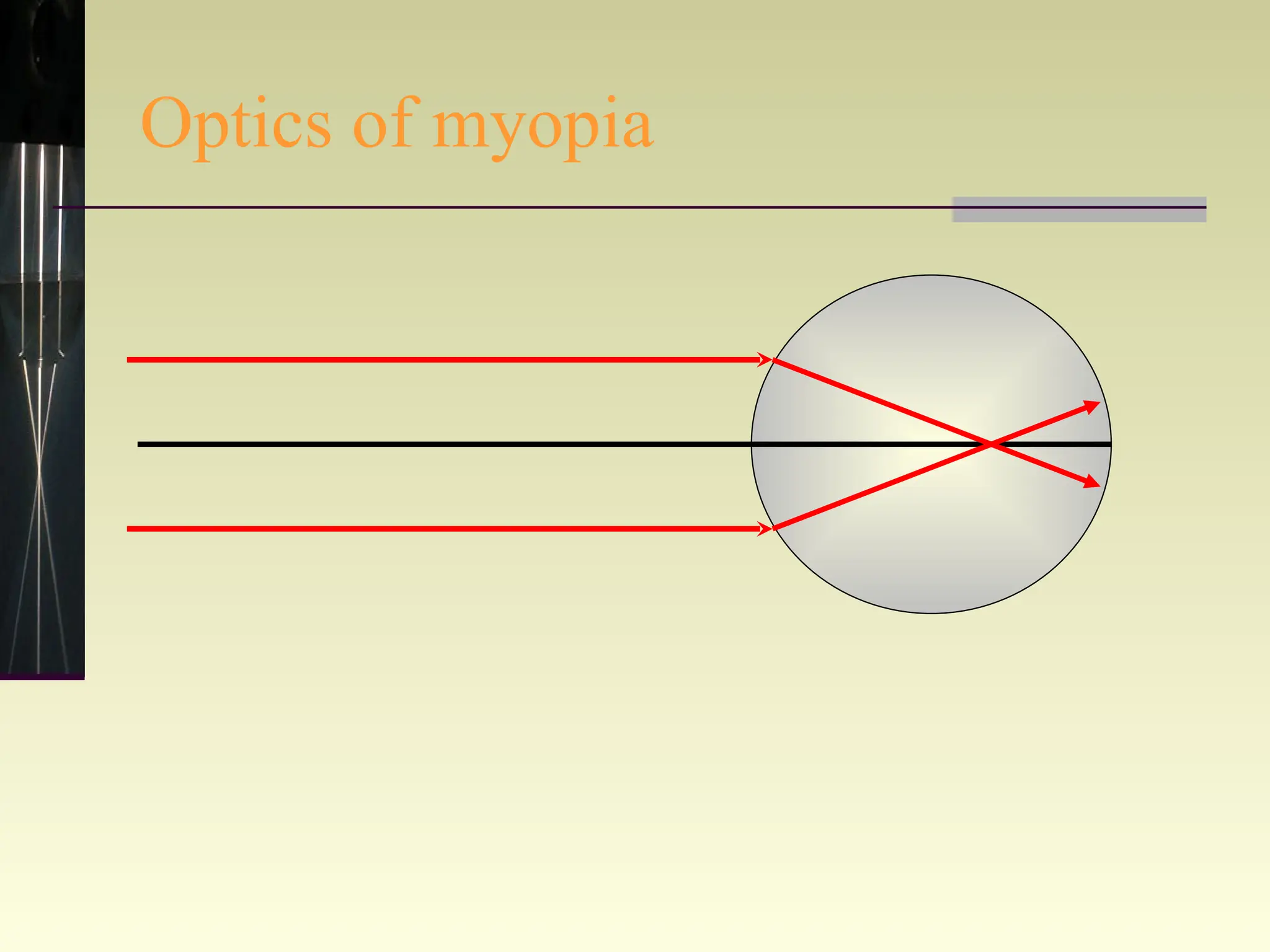 Optics of myopia 