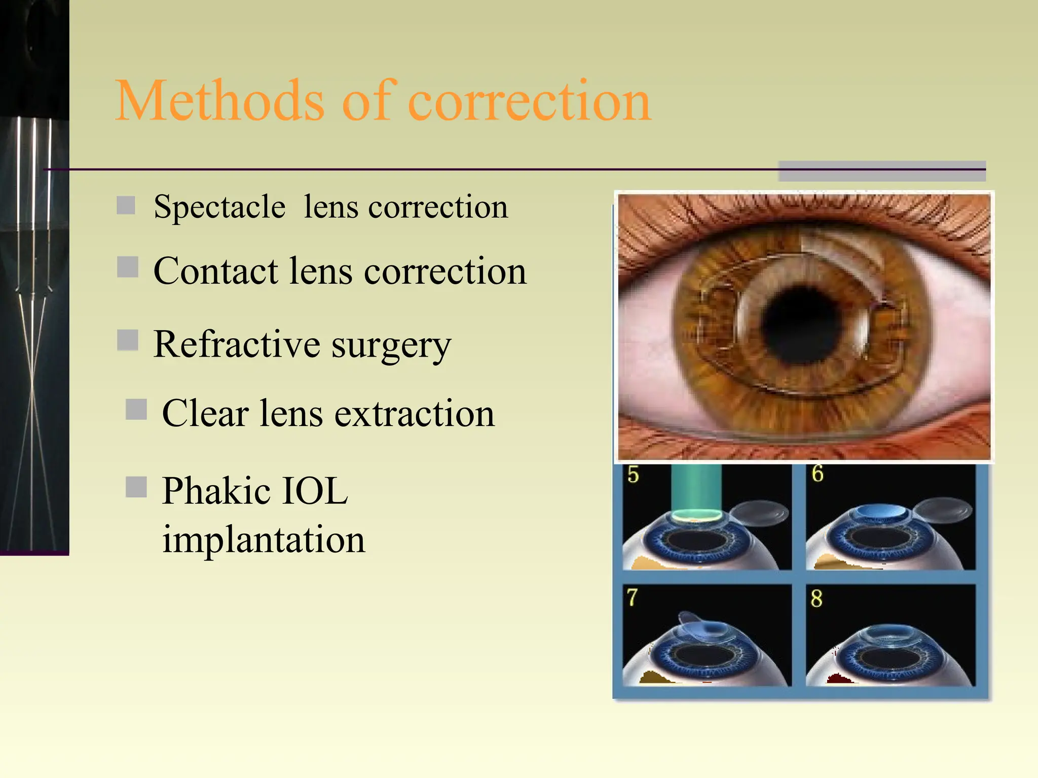 Methods of correction Spectacle  lens correction Refractive surgery Contact lens correction Clear lens extraction Phakic IOL implantation 