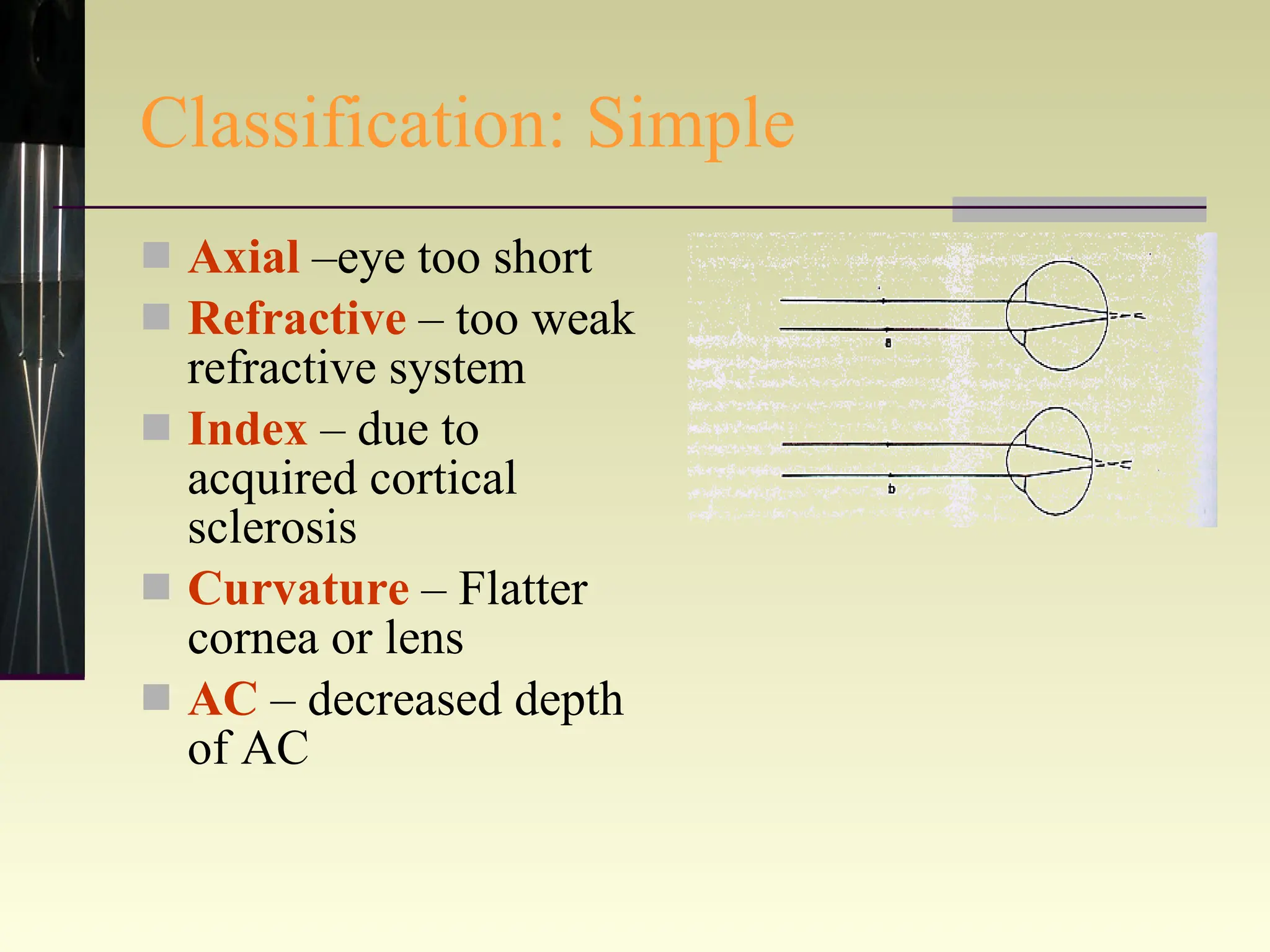 Classification: Simple Axial  –eye too short Refractive  – too weak refractive system Index  – due to acquired cortical sclerosis Curvature  – Flatter cornea or lens AC  – decreased depth of AC 