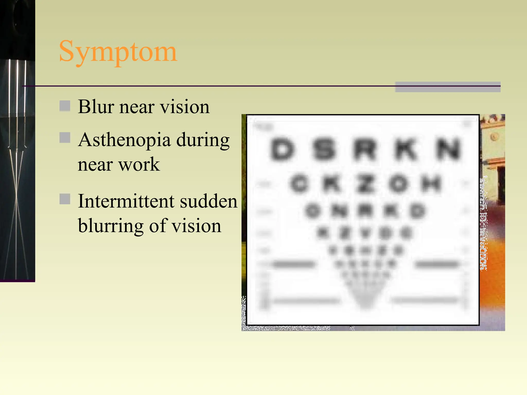 Symptom Blur near vision Intermittent sudden blurring of vision Asthenopia during near work 