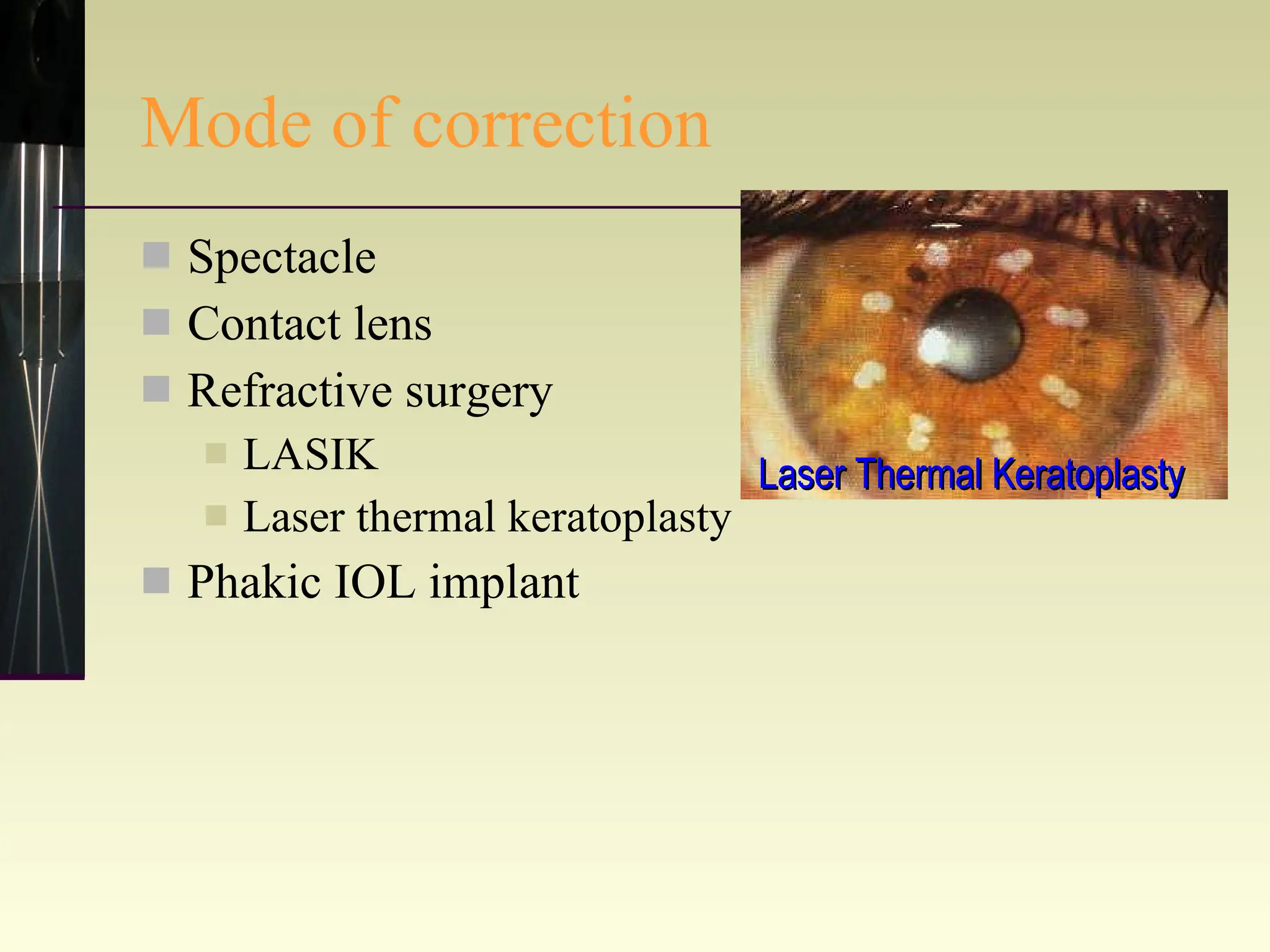 Mode of correction Spectacle Contact lens Refractive surgery LASIK Laser thermal keratoplasty Phakic IOL implant Laser Thermal Keratoplasty 