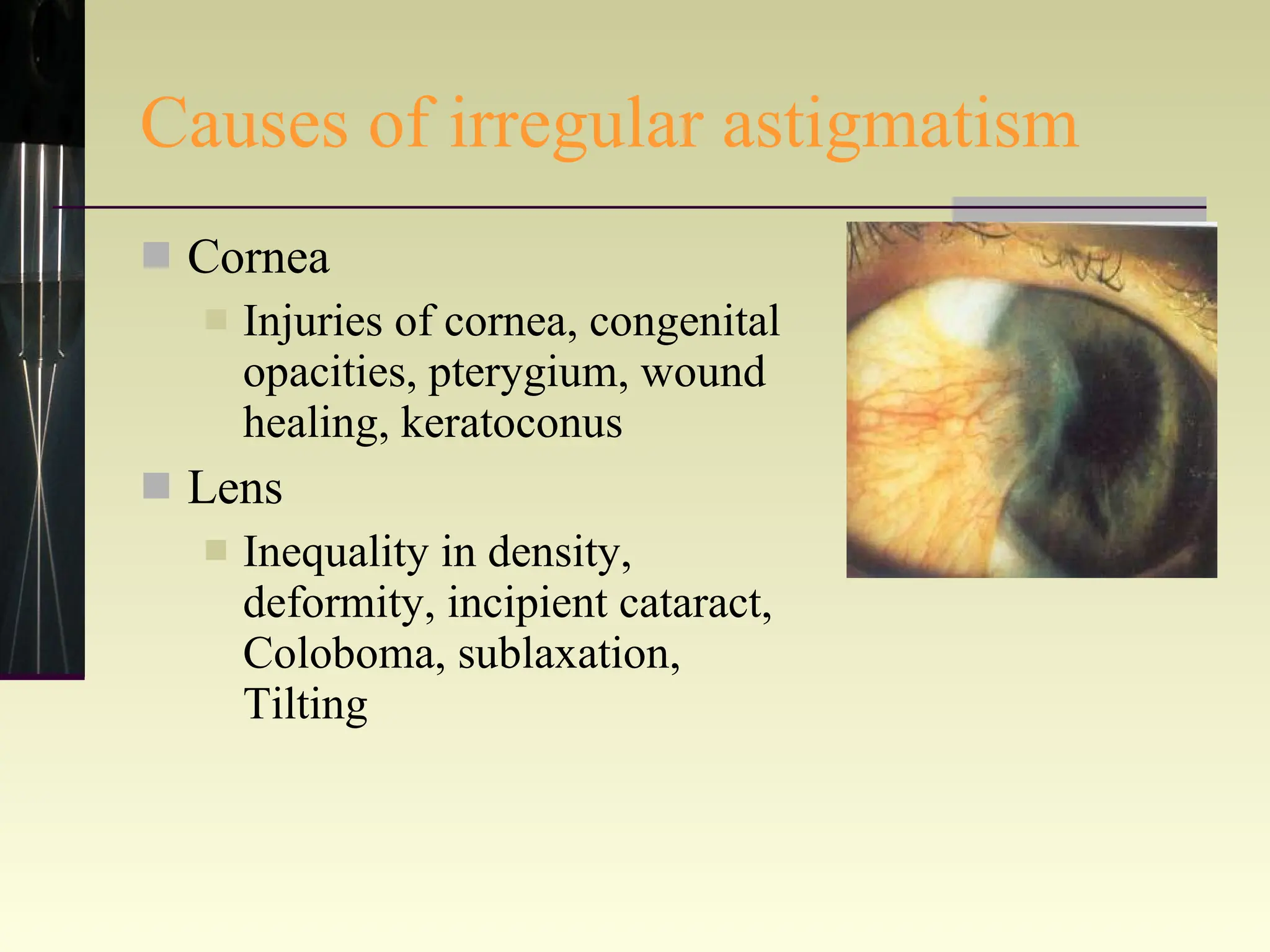 Causes of irregular astigmatism Cornea Injuries of cornea, congenital opacities, pterygium, wound healing, keratoconus Lens Inequality in density, deformity, incipient cataract, Coloboma, sublaxation, Tilting 
