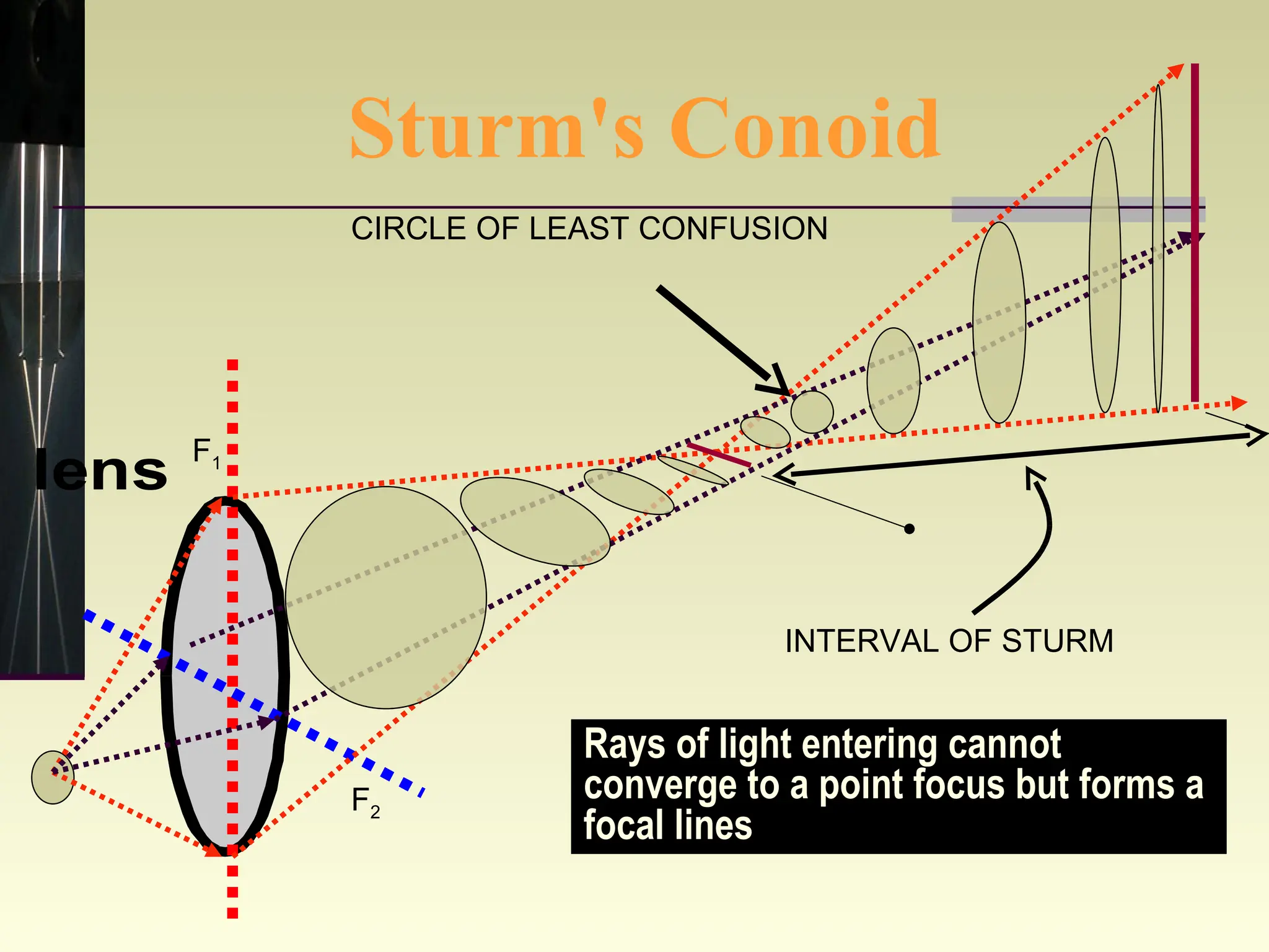 Sturm's Conoid CIRCLE OF LEAST CONFUSION F 1 F 2 INTERVAL OF STURM Rays of light entering cannot converge to a point focus but forms a focal lines 