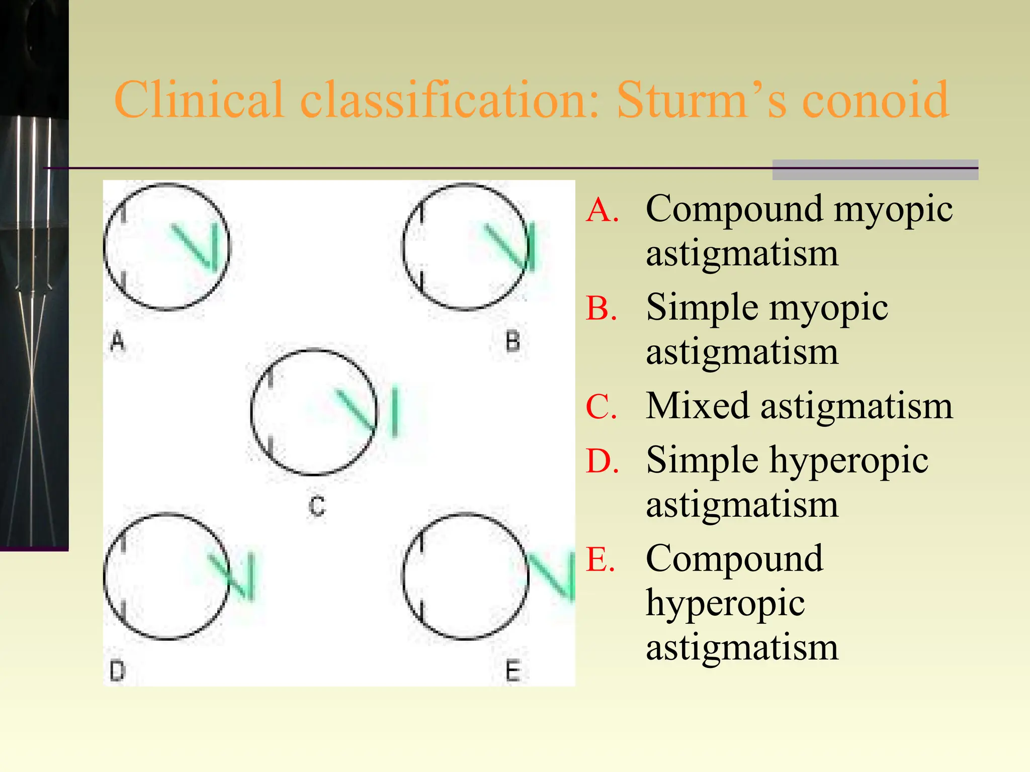 Clinical classification: Sturm’s conoid Compound myopic astigmatism Simple myopic astigmatism Mixed astigmatism Simple hyperopic astigmatism Compound hyperopic astigmatism 