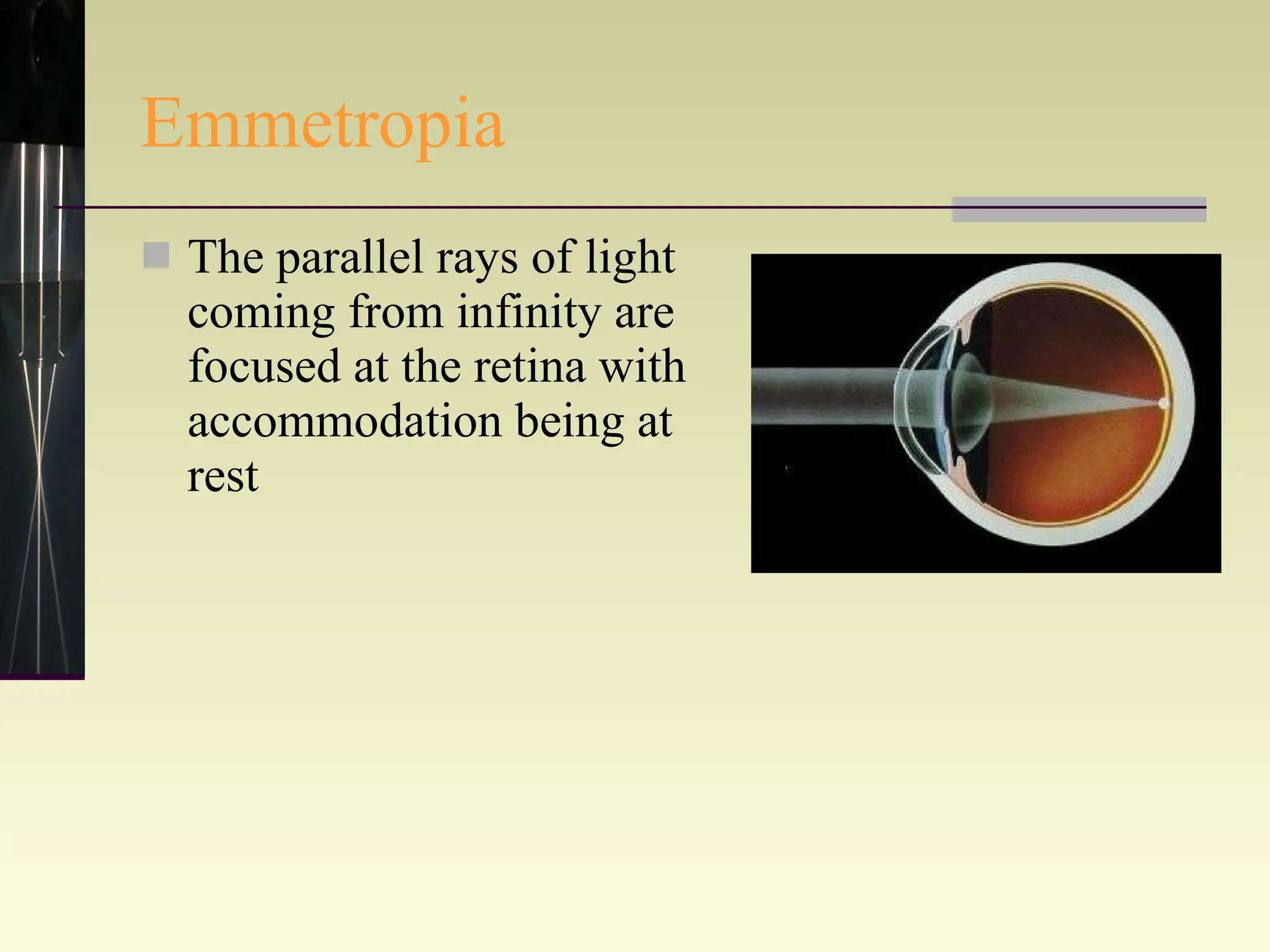 Emmetropia The parallel rays of light coming from infinity are focused at the retina with accommodation being at rest 