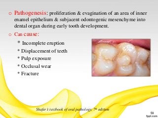 Developmental Anomalies Of Teeth | PPTX