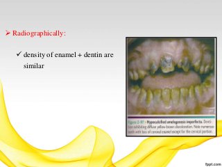 Developmental Anomalies Of Teeth | PPTX