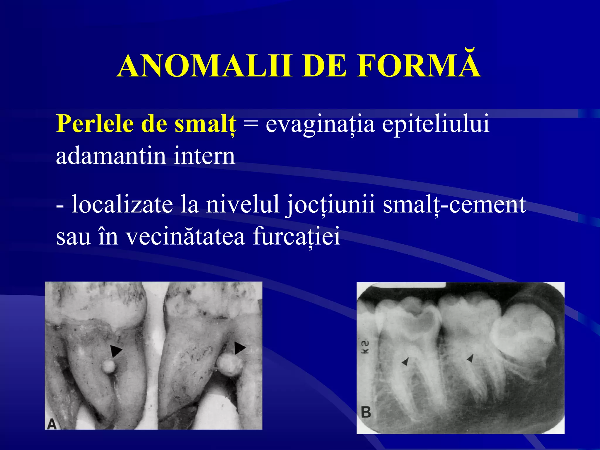 Anomalii dentare | PPT