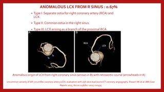 Anomalous coronary arteries: Challenges in Access and Intervention | PPTX