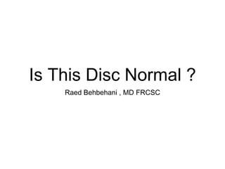 Is This Disc Normal ?
Raed Behbehani , MD FRCSC
 