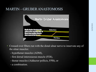 Anomalous Innervation.ppt