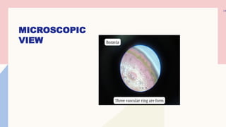 MICROSCOPIC
VIEW
14
 