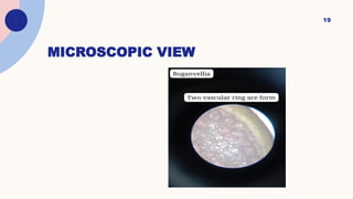 MICROSCOPIC VIEW
19
 