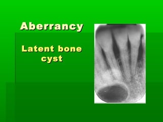 Anomalies of oral & para oral region | PPT