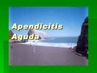 Apendicitis Aguda 