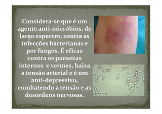 Considera-se que é um
agente anti-micróbios, de
 largo espectro, contra as
  infecções bacterianas e
    por fungos. É eficaz
     contra os parasitas
internos e vermes, baixa
  a tensão arterial e é um
      anti-depressivo,
combatendo a tensão e as
   desordens nervosas.
 