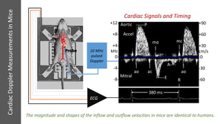 Ms Inflow Signal A Noninvasive Alternative to +dP/dtmax: Peak Aortic Blood Acceleration ...