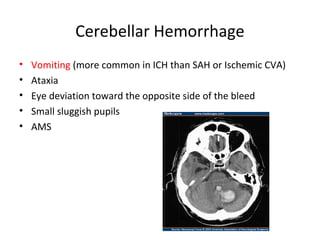 Cerebellar Hemorrhage
• Vomiting (more common in ICH than SAH or Ischemic CVA)
• Ataxia
• Eye deviation toward the opposite side of the bleed
• Small sluggish pupils
• AMS
 