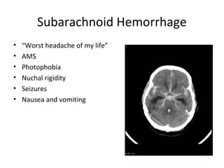 Subarachnoid Hemorrhage
• “Worst headache of my life”
• AMS
• Photophobia
• Nuchal rigidity
• Seizures
• Nausea and vomiting
 