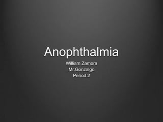 Anophthalmia
   William Zamora
    Mr.Gonzalgo
       Period:2
 