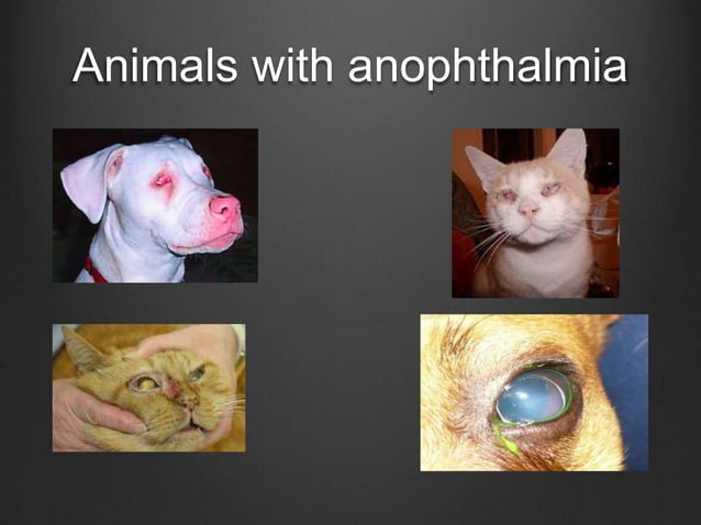Anophthalmia | PPTX