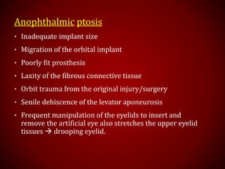 Anophthalmic ptosis
• Inadequate implant size
• Migration of the orbital implant
• Poorly ﬁt prosthesis
• Laxity of the ﬁbrous connective tissue
• Orbit trauma from the original injury/surgery
• Senile dehiscence of the levator aponeurosis
• Frequent manipulation of the eyelids to insert and
remove the artificial eye also stretches the upper eyelid
tissues  drooping eyelid.
 