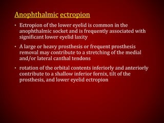 Anophthalmic ectropion
• Ectropion of the lower eyelid is common in the
anophthalmic socket and is frequently associated with
significant lower eyelid laxity
• A large or heavy prosthesis or frequent prosthesis
removal may contribute to a stretching of the medial
and/or lateral canthal tendons
• rotation of the orbital contents inferiorly and anteriorly
contribute to a shallow inferior fornix, tilt of the
prosthesis, and lower eyelid ectropion
 