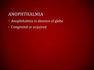 ANOPHTHALMIA
• Anophthalmia is absence of globe
• Congenital or acquired
 