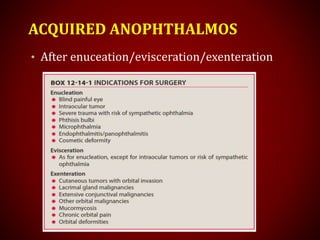 ACQUIRED ANOPHTHALMOS
• After enuceation/evisceration/exenteration
 