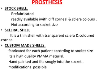 Cornial Shell Anophthalmic socket | PPTX