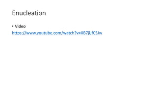 Enucleation
• Video
https://www.youtube.com/watch?v=XB7jlJfCSJw
 