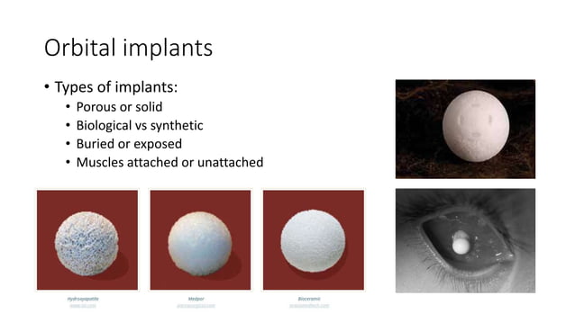 Anophthalmic socket (evisceration, enucleation, exenteration) | PPTX ...
