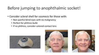 Before jumping to anophthalmic socket!
• Consider scleral shell for cosmesis for those with:
• Non-painful blind eyes with no malignancy
• Perfect for phthisis bulbi
• If no phthisis, consider colored contact lens
 