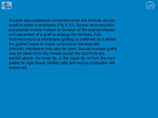 Anophthalmic socket.pptx