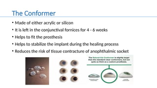 anophthalmic-socket-pptx-tru-ffhnnkfdhh-pptx