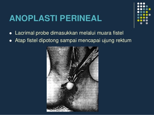 Y V Ø§Ø°Ø§ Ø§Ø±Ø§Ø¯Øª Ø§Ù„Ù…Ø±Ø§Ø© Ø§ØºØ±Ø§ Ø§Ù„Ø±Ø¬Ù„ : Tipos de pÃ¡rrafo - ÙÙÙŠ